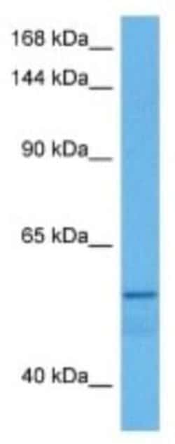 EphA8 Rabbit anti-Human, Polyclonal, Novus Biologicals 100 &mu;g; Unconjugated:Antibodies,